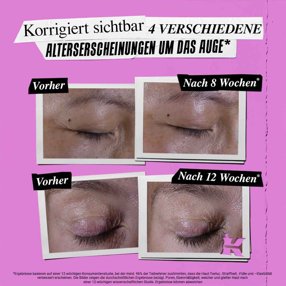 Vorher-Nachher-Foto der Kiehl's Super Multi-Corrective Eye Zone Treatment zur Korrektur von Anzeichen der Hautalterung