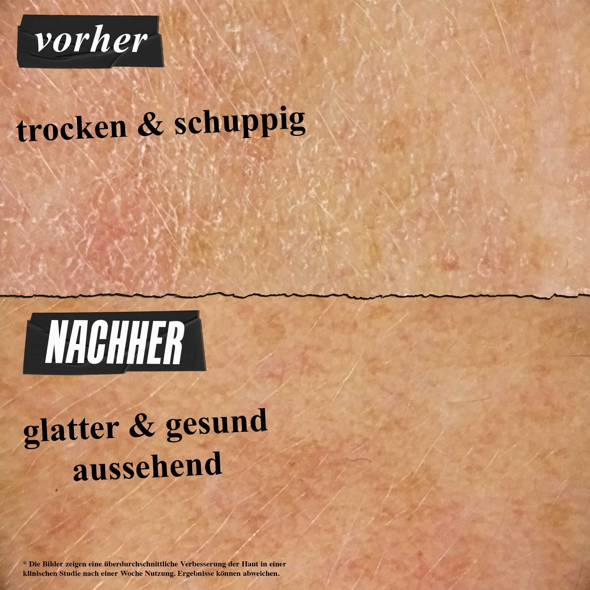 Vorher-Nachher-Foto – Ultra Facial Cream sorgt fur weichere, besser mit Feuchtigkeit versorgte Haut