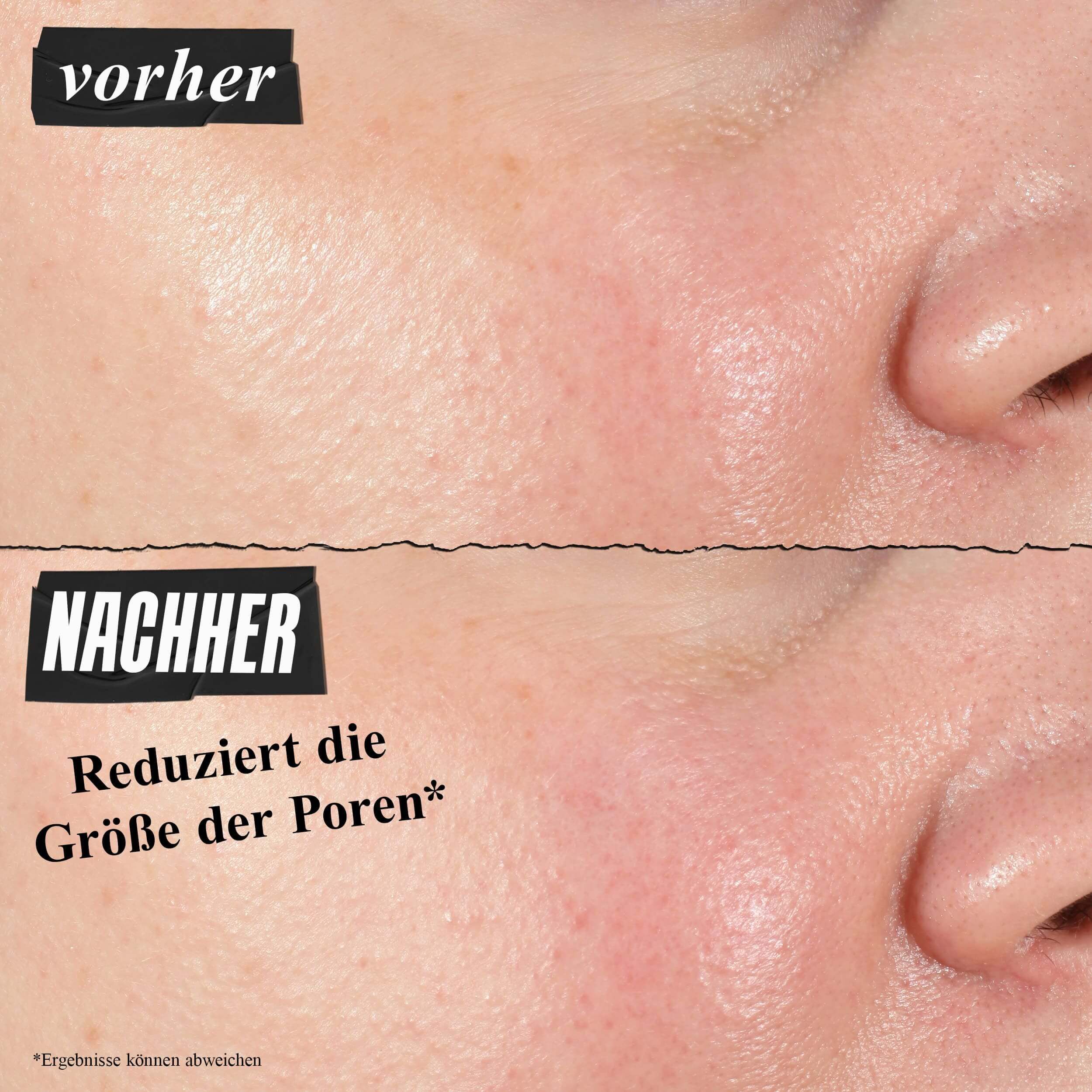 Vorher-Nachher-Foto – Kiehl's Hydro Plumping Serum Concentrate reduziert sichtbar Poren
