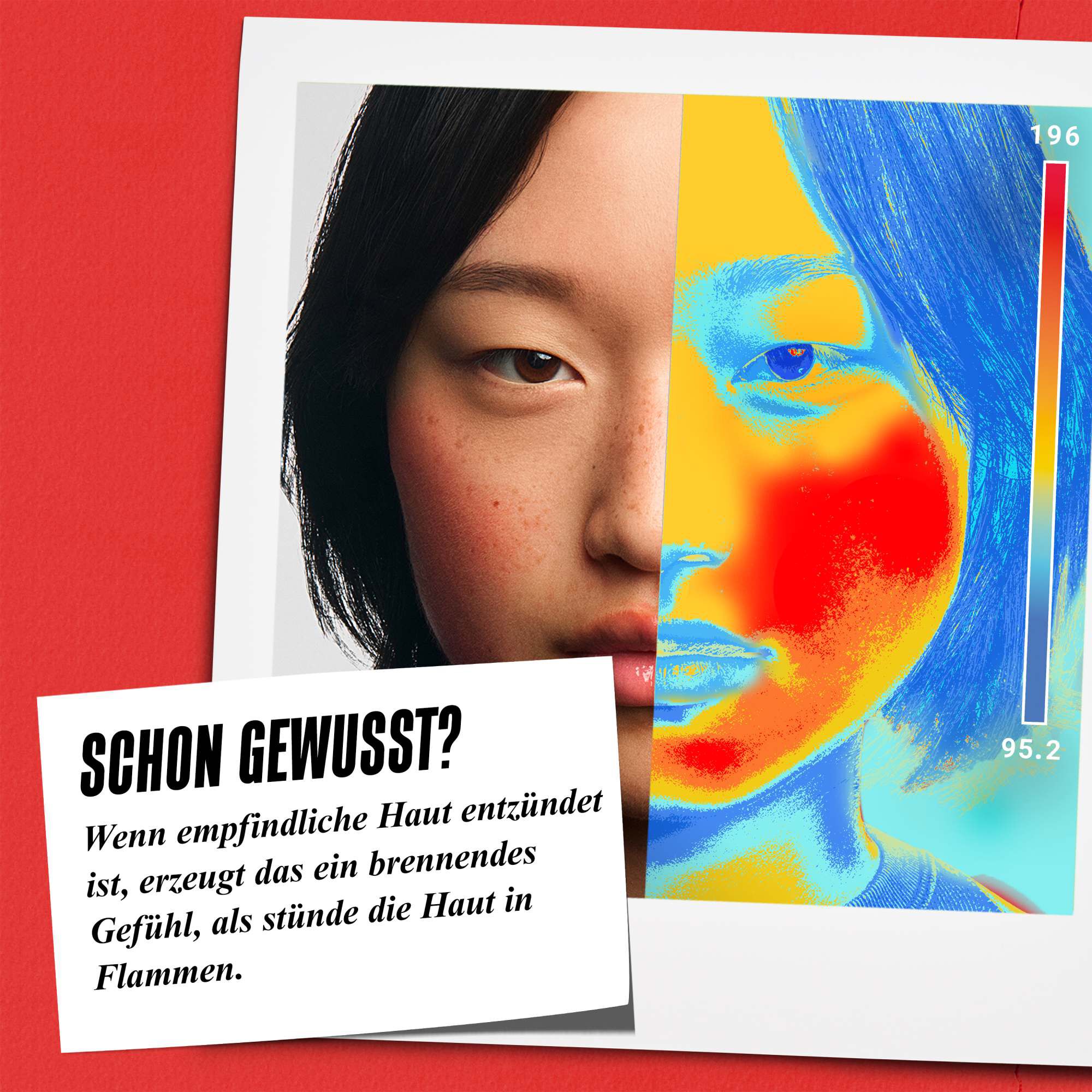 Wussten Sie schon? Wenn empfindliche Haut entzundet ist, entsteht ein Brennen, durch das sich die Haut angegriffen anfuhlt.