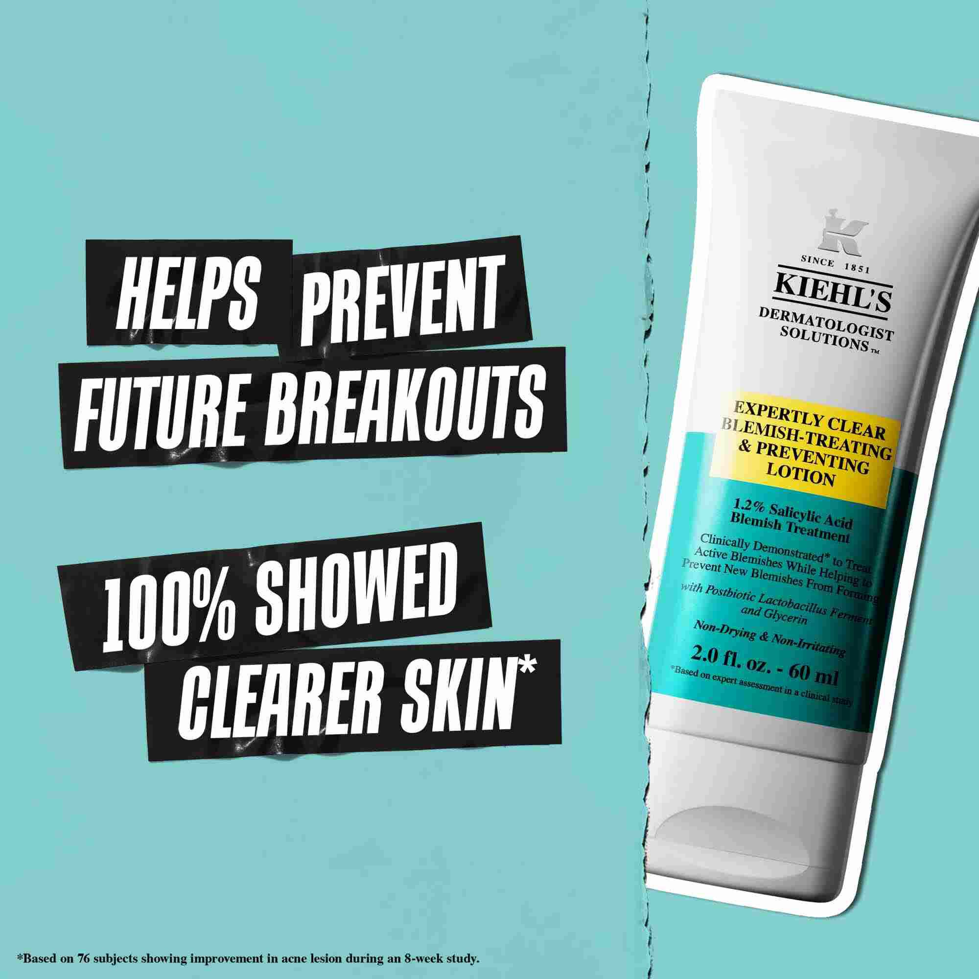 Eine Tube Expertly Clear Blemish-Treating & Preventing Lotion vor blauem Hintergrund mit dem Text: „Hilft, zukunftigen Ausbruchen vorzubeugen“ und „100 % zeigten reinere Haut“.