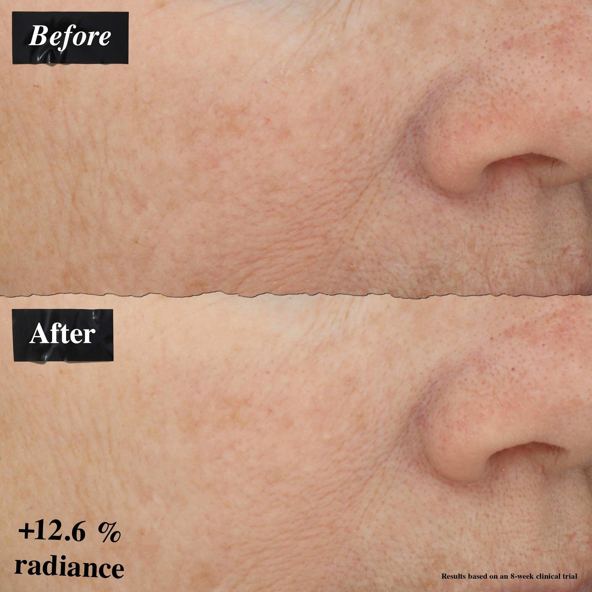 Une comparaison avant/apres montrant une amelioration des rougeurs de la peau apres utilisation du Powerful-Strength Line-Reducing Concentrate.