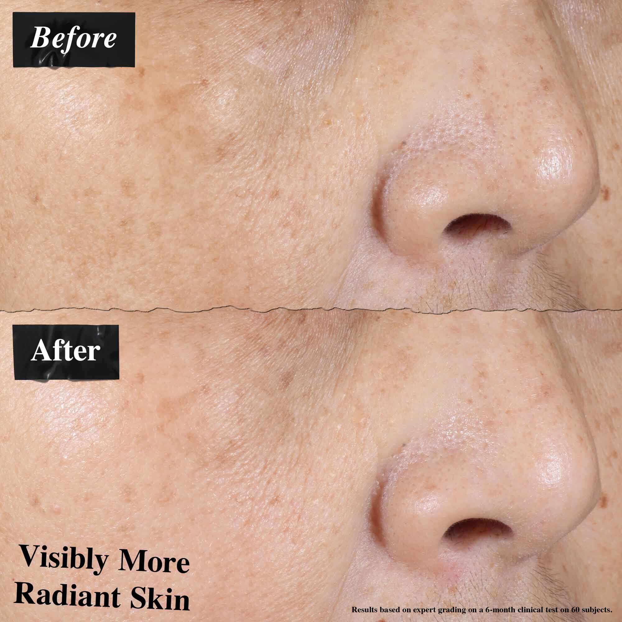 Comparaison avant/apres montrant une reduction visible des rougeurs de la peau apres utilisation de l'Ultra-Light Daily UV Defense.