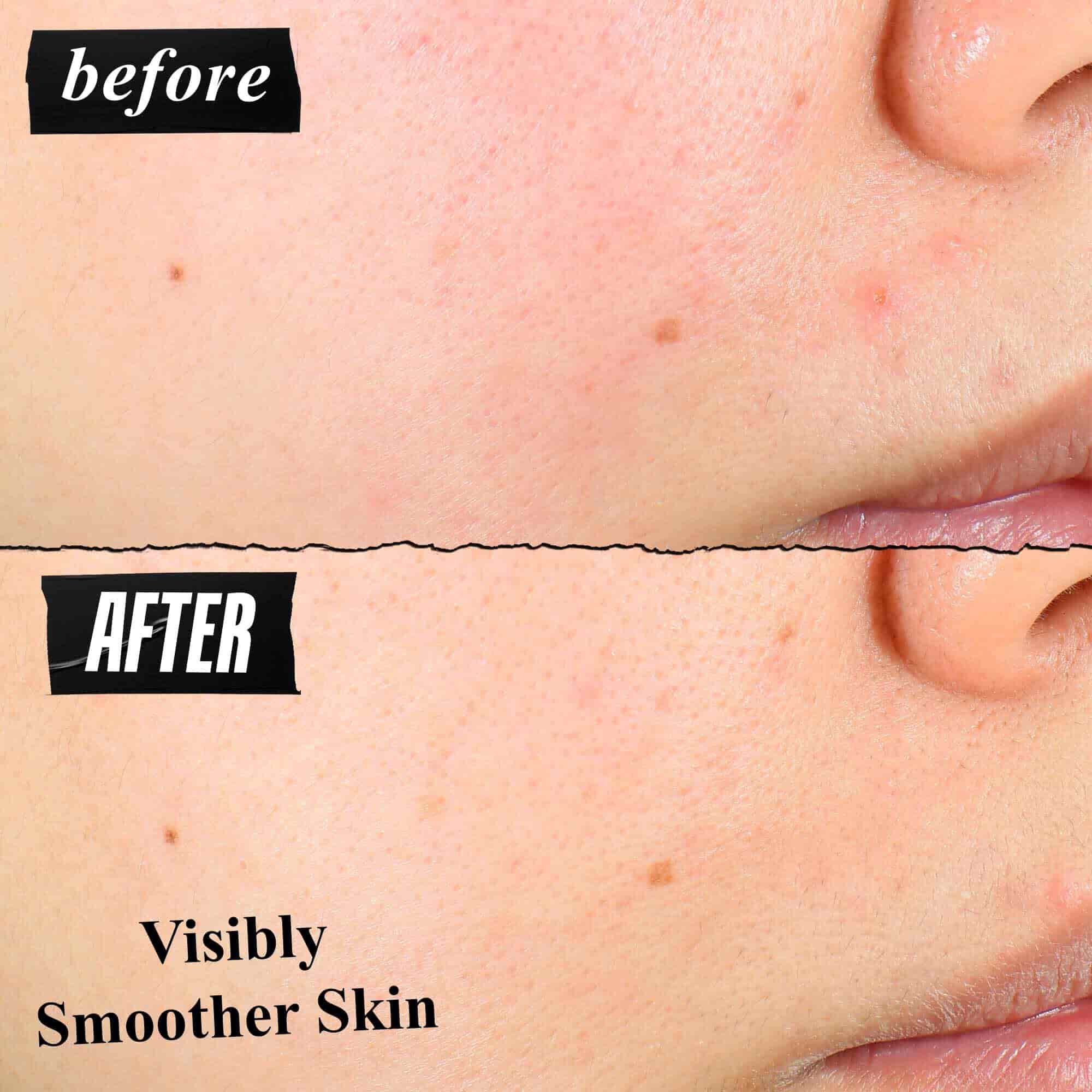 Une comparaison avant/apres de la texture de la peau montrant une peau visiblement plus lisse apres utilisation.