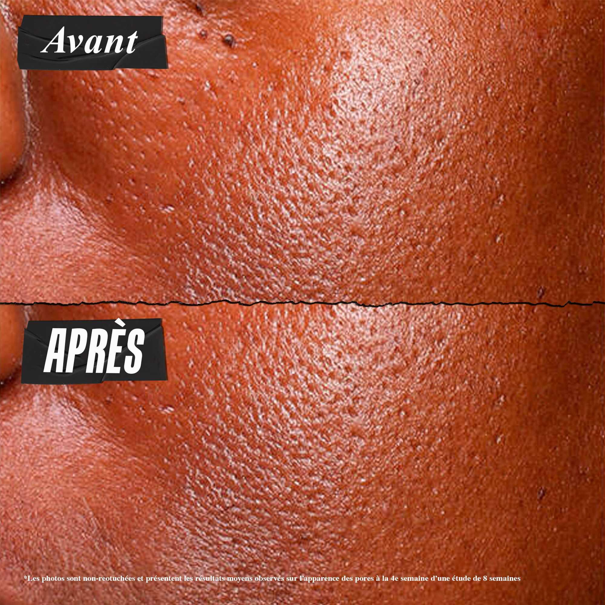 Photo Avant/Apres du Serum Ultra Pure Kiehl's reduisant visiblement l'exces de sebum