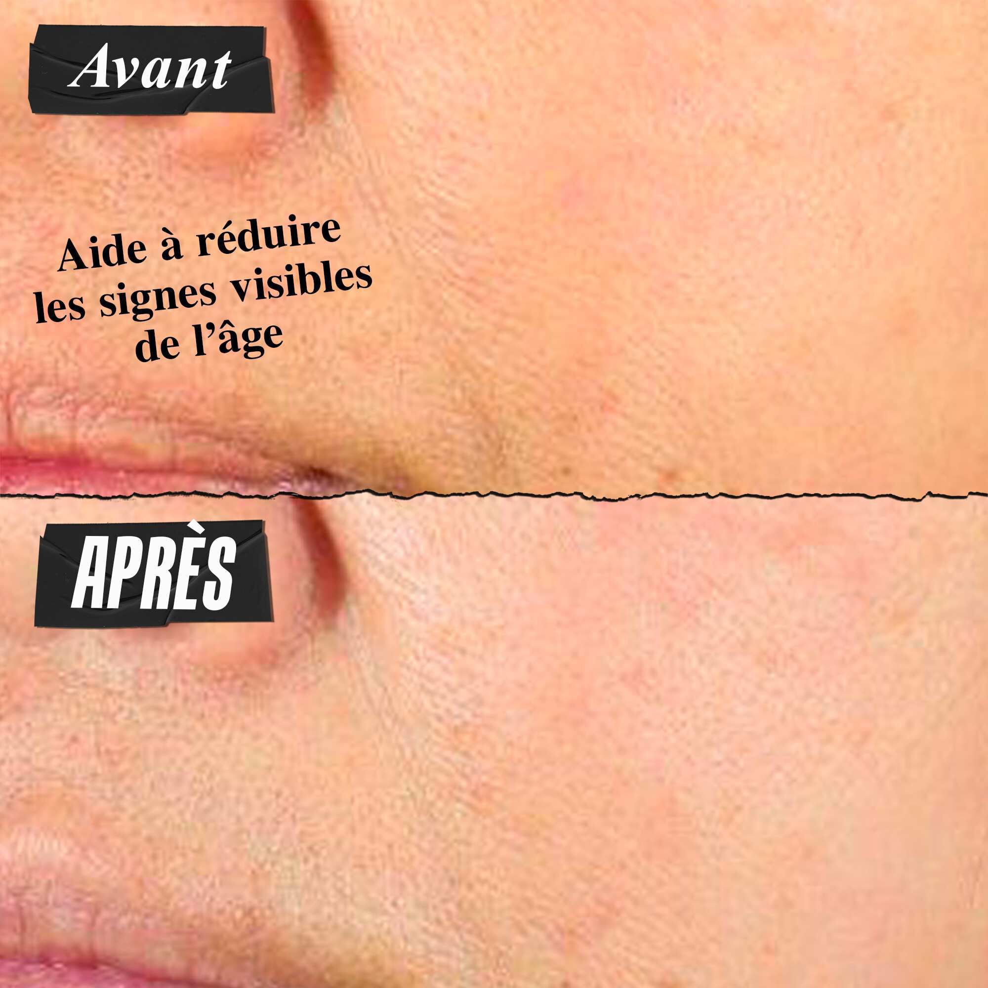 Photo Avant/Apres : la Super Multi-Corrective Cream Kiehl's aide a ameliorer les signes visibles de la perte de collagene