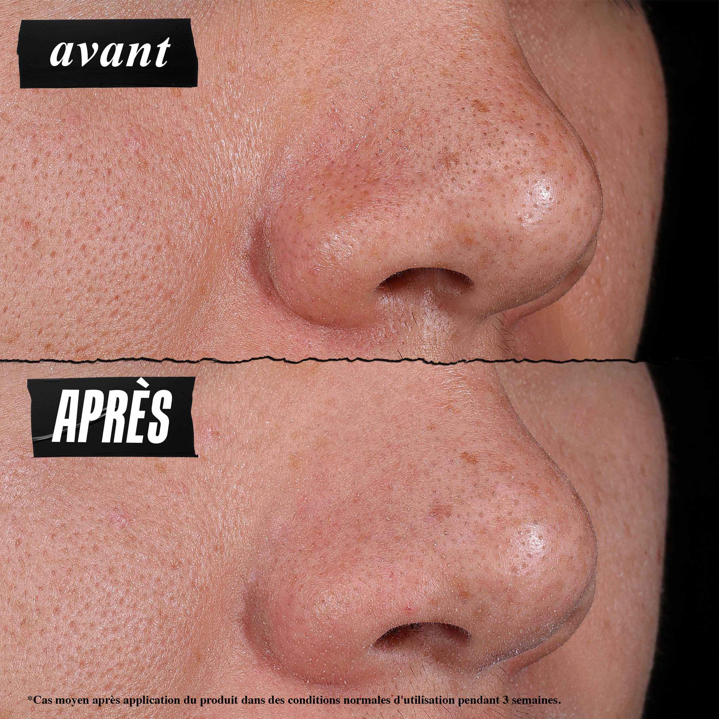 Photo Avant/Apres - Le Masque Nettoyant Rare Earth Kiehl's reduit visiblement les pores