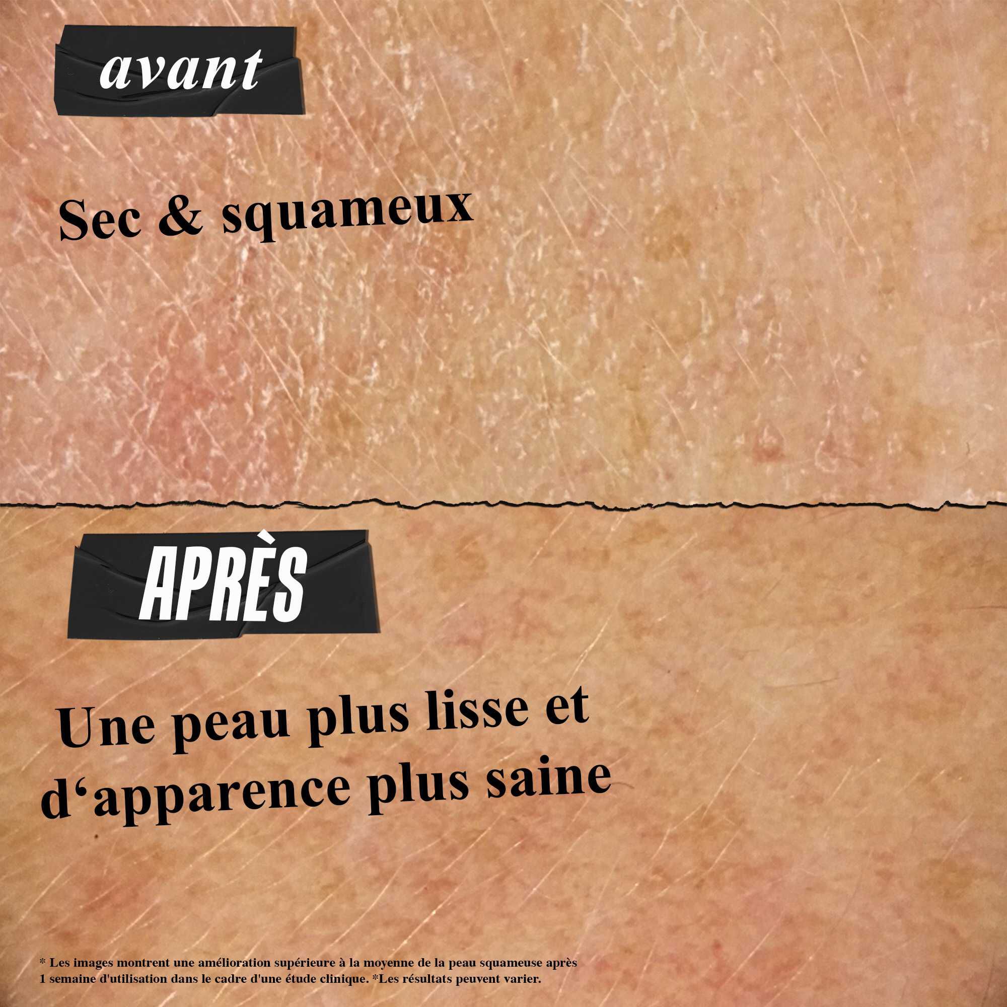 Photo Avant/Apres - La creme Ultra Facial rend la peau plus douce et plus hydratee