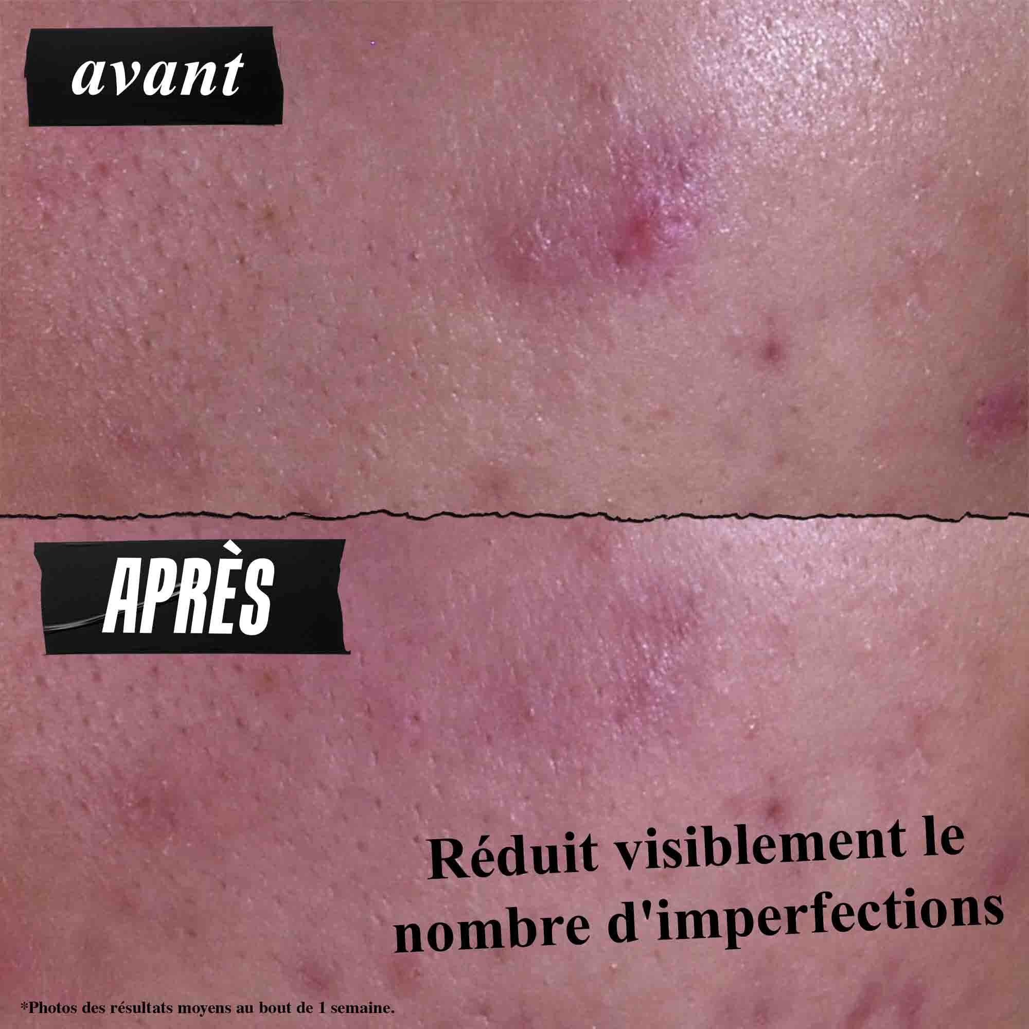 Gently Effective Blemish-Treating Cleansing Paste