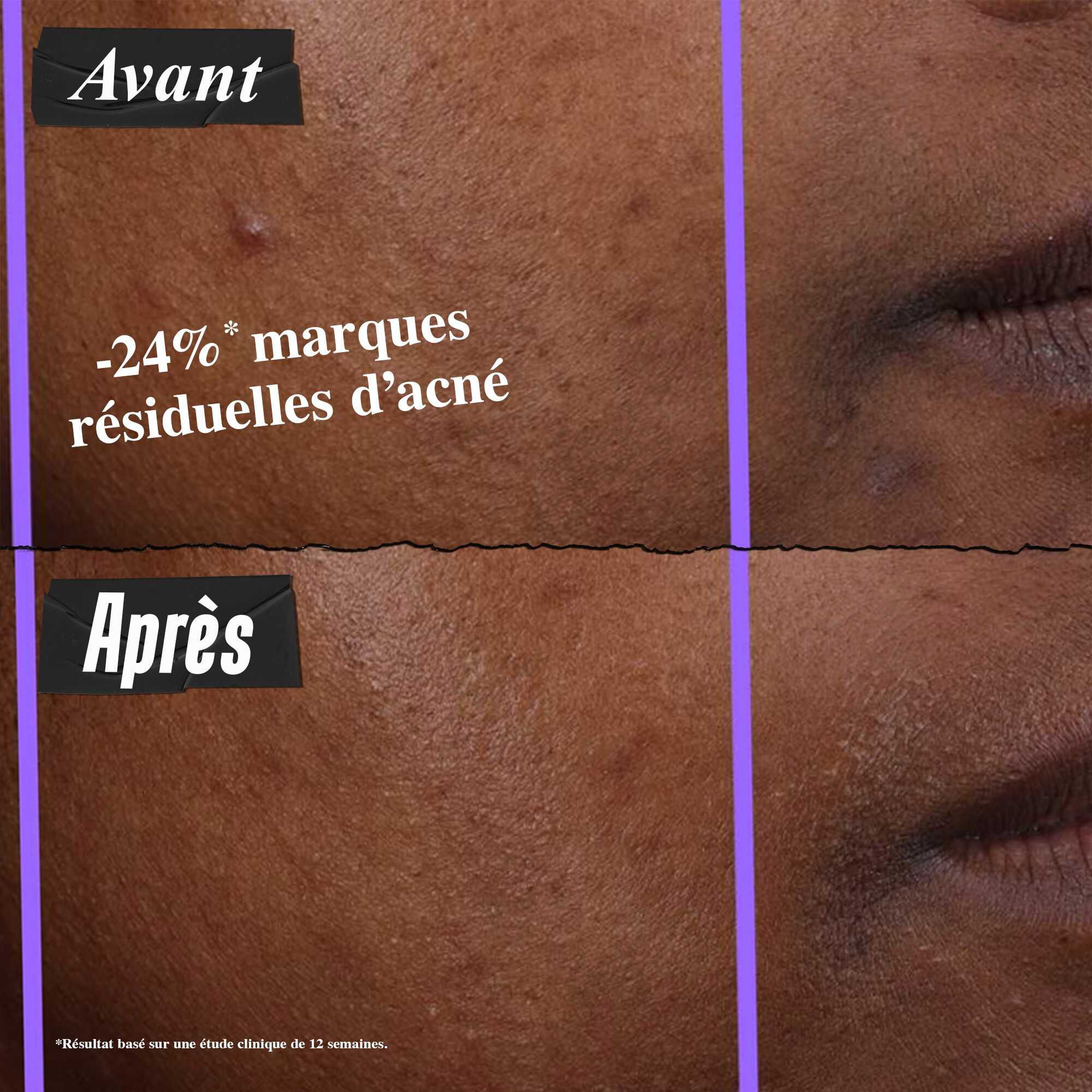 Clearly Corrective™ Clarity-Activating Soothing Emulsion