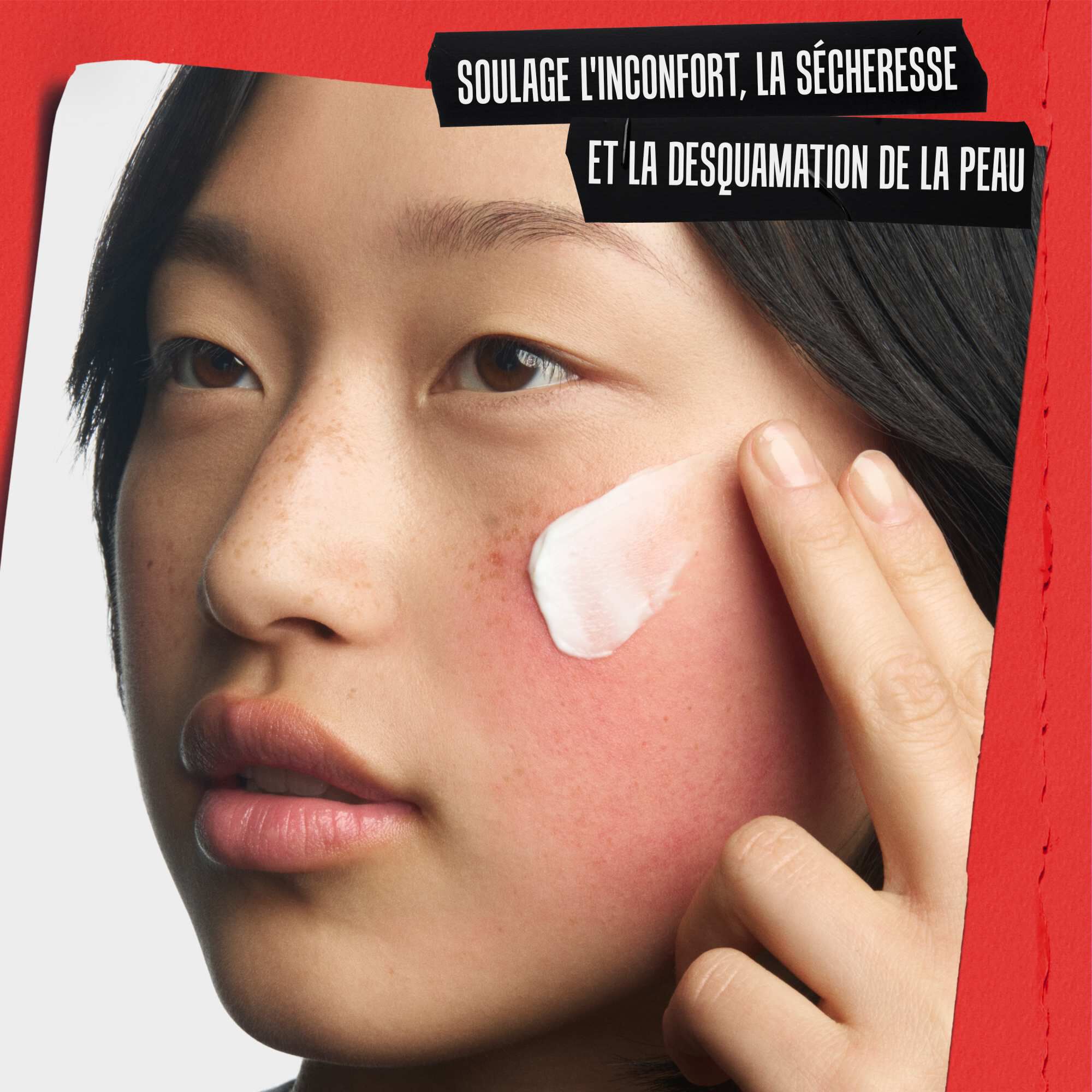 Gros plan sur l'application de la creme reparatrice sur une joue irritee. Le texte indique : SOULAGE L'INCONFORT CUTANE, LA SECHERESSE ET LES DESQUAMATIONS.