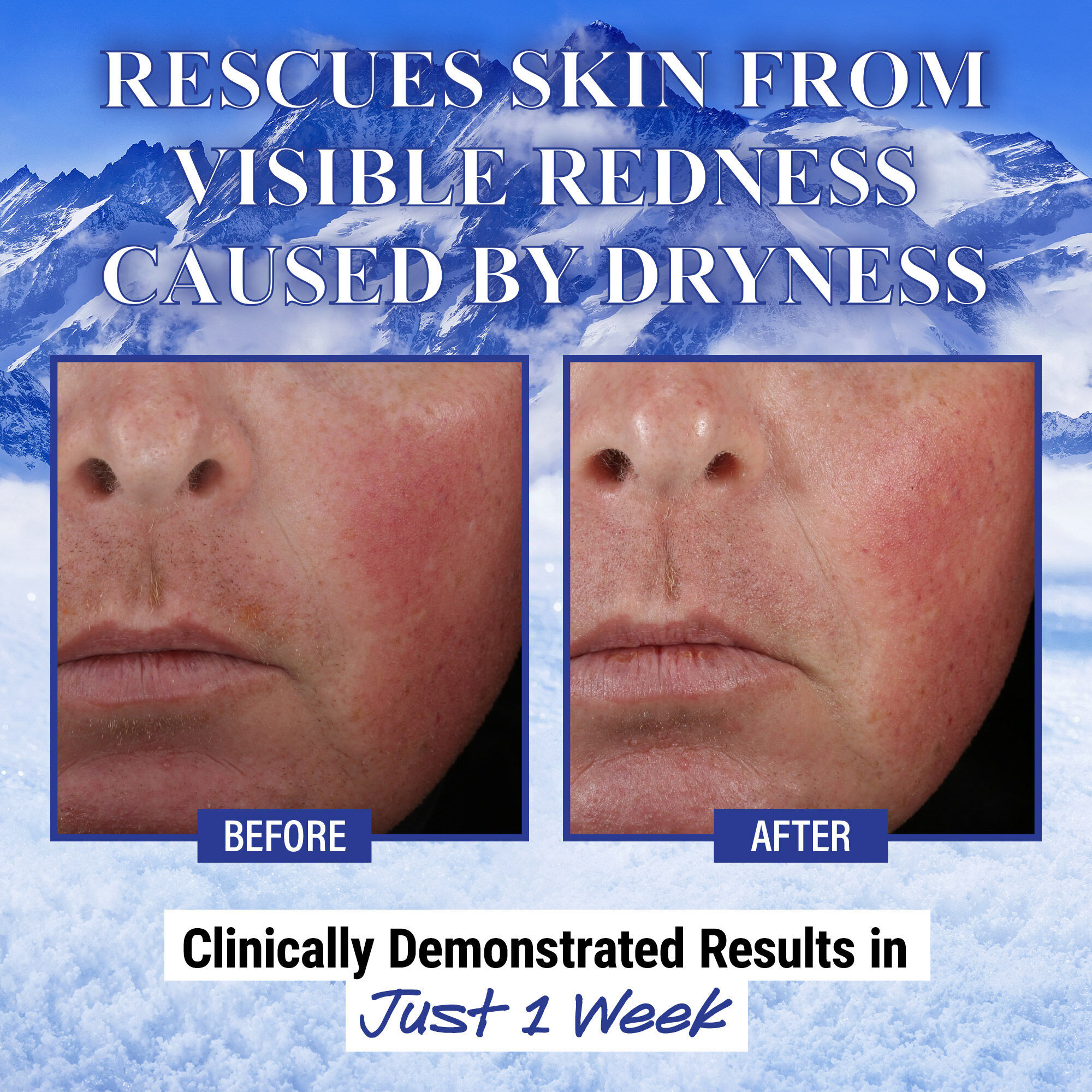 Ingredients de la creme barriere Ultra Facial Kiehl's - Avoine colloidale, Beta-glucane