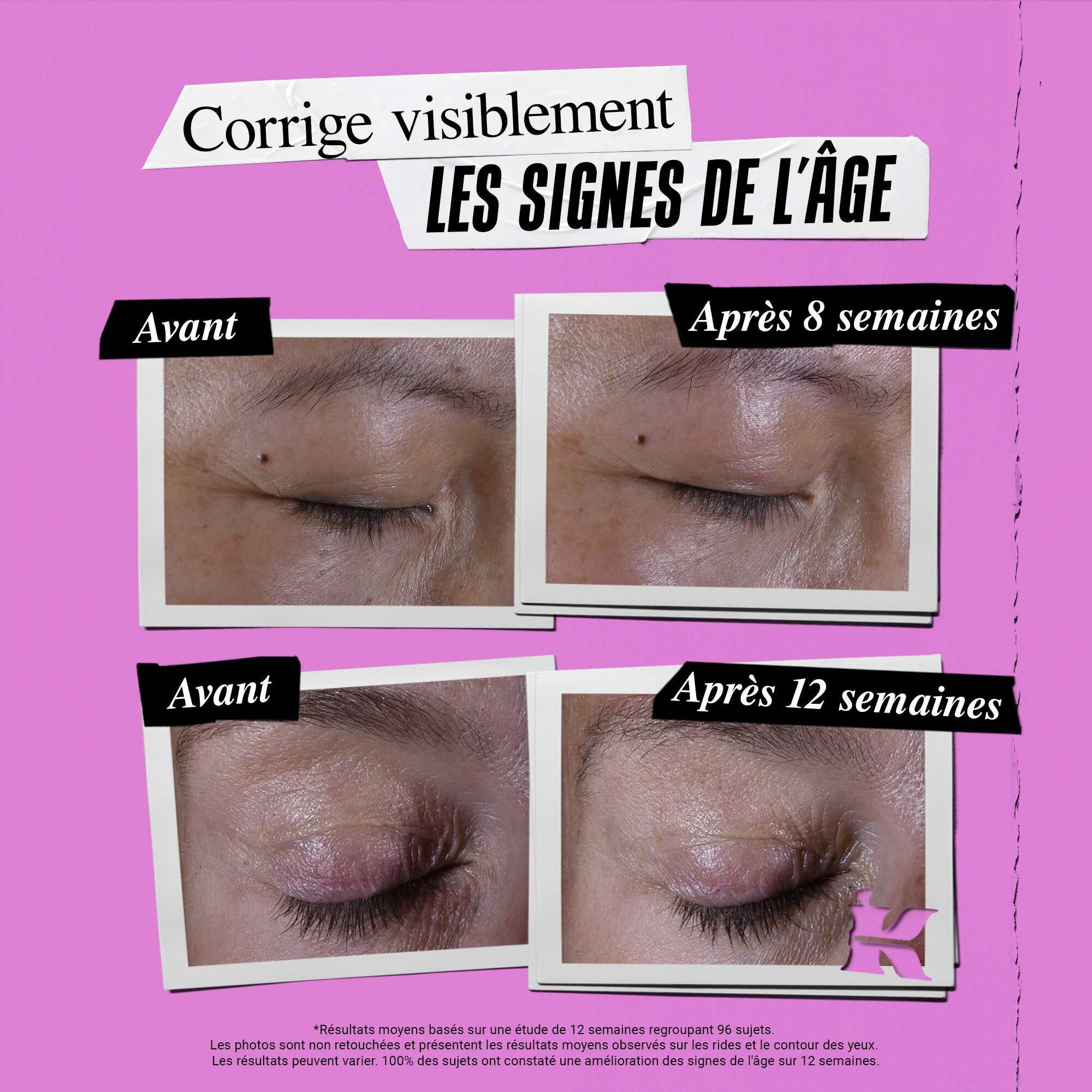 Photo Avant/Apres du Soin Yeux Zone Regard Super Multi-Corrective Kiehl's corrigeant les signes de l'age