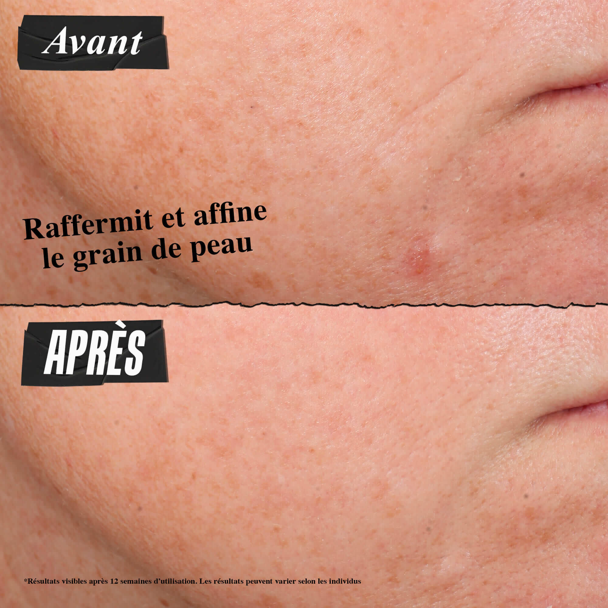 Photo Avant/Apres - Kiehl's Retinol Skin-Renewing Daily Micro-Dose aide a ameliorer le teint et le grain de peau