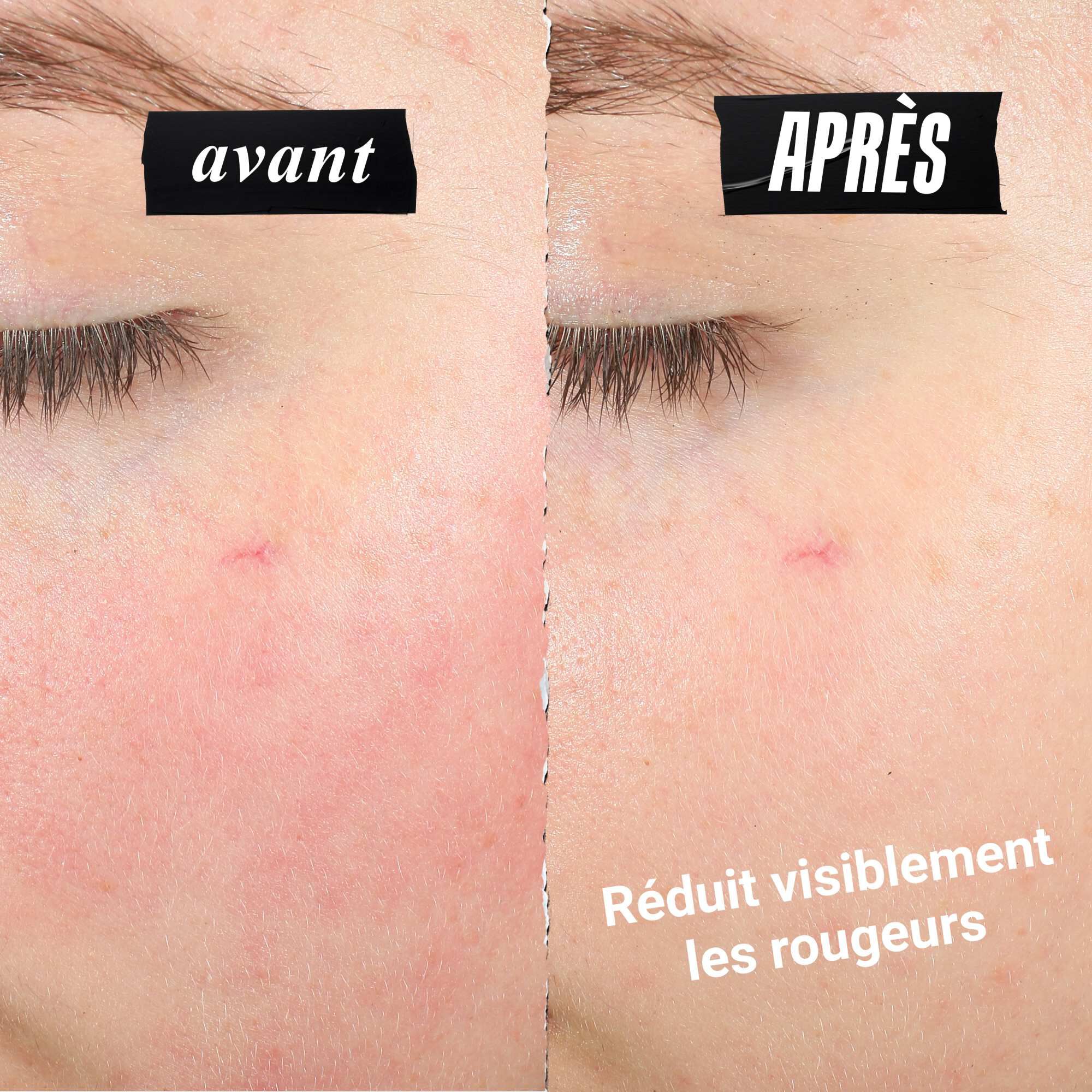 Comparaison montrant une reduction des rougeurs sur la peau. Le texte indique : Reduit visiblement les rougeurs.