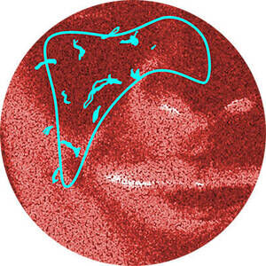 Derma Reader von Kiehl's: Analyse der Hautrotungen