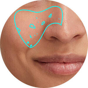 Derma Reader von Kiehl's: Analyse der vergroßerten Poren