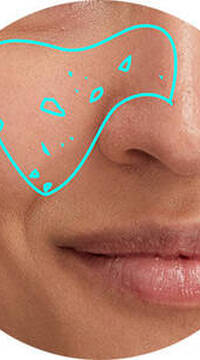 Derma Reader von Kiehl's: Analyse der vergroßerten Poren