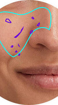 Derma Reader von Kiehl's: Analyse der Pickelmale