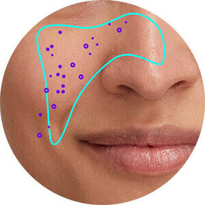 Derma Reader von Kiehl's: Analyse der verstopften Poren