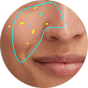 Derma Reader von Kiehl's: Analyse der Hauttextur