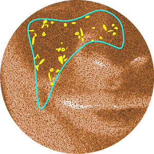 Derma Reader von Kiehl's: Analyse der Altersflecken