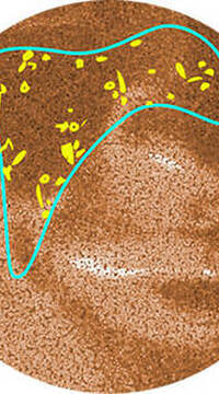 Derma Reader von Kiehl's: Analyse der Altersflecken
