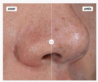 A bowl containing light gray clay powder next to an open jar of Kiehl's Rare Earth Deep Pore Cleansing Masque, with a pestle resting against the bowl.