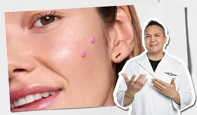 Gros plan sur la joue du mannequin avec des points roses de serum montrant le placement de l’application, accompagnee d’une figure experte en blouse blanche qui fait signe du tutoriel de soins de la peau.