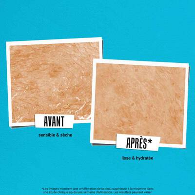 Avant et apres de la peau, montrant une texture sensible et seche a gauche et une texture lisse et hydratee a droite, sur fond bleu.
