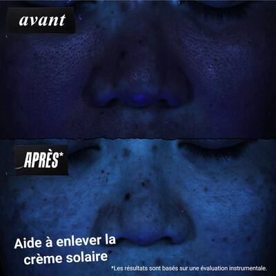Images comparatives montrant l'evolution de la peau apres une semaine et quatre semaines de traitement, avec des zones marquees "avant" et "apres".