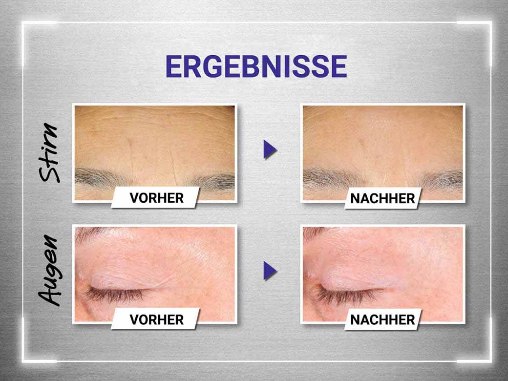 RETINOLRATGEBER Alles über den Wirkstoff Kiehl